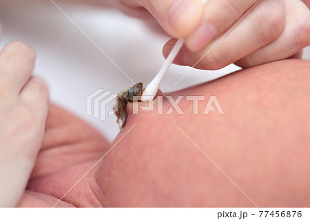 新生児のへそを消毒するママの写真素材