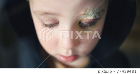 Close-up of sad small boy with cut eyebrow standing indoors at home, poverty concept. 77459481