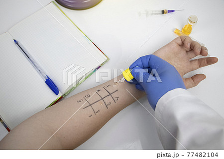 An allergist doctor in the laboratory conducts a prik allergy test. Skin test for household, food, epidermal allergic reactions An allergist doctor in the laboratory conducts a prik allergy test. Skin test for household, food, epidermal allergic reactions 77482104