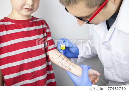 An allergist doctor makes a skin test for allergies. The boy is being examined in the laboratory, waiting for a reaction to allergens. 77482750