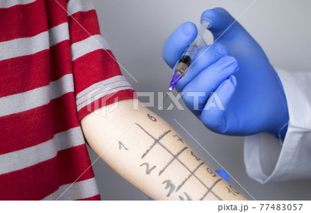 An allergist doctor makes a skin test for allergies. The boy is being examined in the laboratory, waiting for a reaction to allergens. An allergist doctor makes a skin test for allergies. The boy is being examined in the laboratory, waiting for a reaction to allergens. 77483057