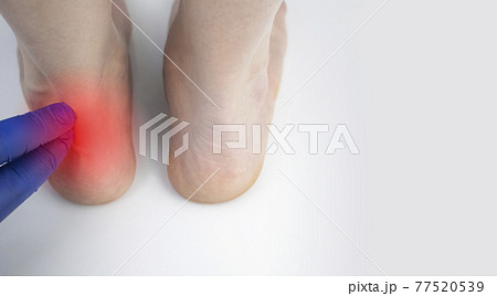 An orthopedic doctor examines a woman's leg. Achilles tendon and ankle diseases. Inflammation of the heel and foot, achillobursitis and achillotomy, rheumatism, tendon rupture An orthopedic doctor examines a woman's leg. Achilles tendon and ankle diseases. Inflammation of the heel and foot, achillobursitis and achillotomy, rheumatism, tendon rupture 77520539