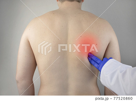 Shoulder pain. A man at a doctor appointment with a vertebrologist complaining of pain in the interscapular region and back. Shoulder pain. A man at a doctor appointment with a vertebrologist complaining of pain in the interscapular region and back. 77520860