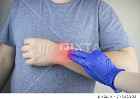 A man wrist hurts. Traumatologist examines a hand. Wrist pain as a sign of tunnel syndrome or sprain, tendon degeneration, arthritis A man wrist hurts. Traumatologist examines a hand. Wrist pain as a sign of tunnel syndrome or sprain, tendon degeneration, arthritis 77521802