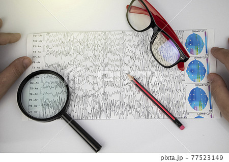 A neurologist examines an encephalogram of a patient brain. Schedule of electroencephalograms - study of brain currents for signs of epilepsy and pathologies of the nervous system A neurologist examines an encephalogram of a patient brain. Schedule of electroencephalograms - study of brain currents for signs of epilepsy and pathologies of the nervous system 77523149