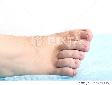 Human toe hair. Leg hair removal concept. Copy space for text Human toe hair. Leg hair removal concept. Copy space for text 77529119