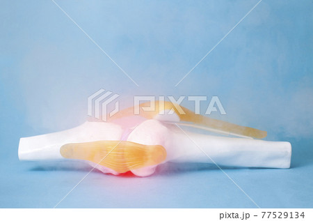 Knee joint mockup on a blue background and liquid nitrogen. Joint treatment concept with ozone therapy. Ultra-low temperature treatment Knee joint mockup on a blue background and liquid nitrogen. Joint treatment concept with ozone therapy. Ultra-low temperature treatment 77529134