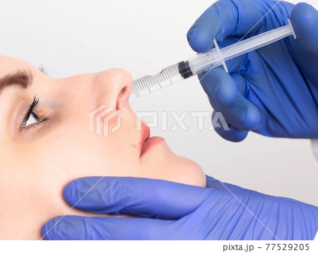 The doctor makes the procedure to the girl patient an intranasal block, close-up. Treatment concept for dry and burning nose 77529205