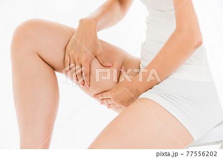 太もものセルライト 77556202