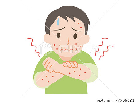 じんましんの出ている男性 77596031