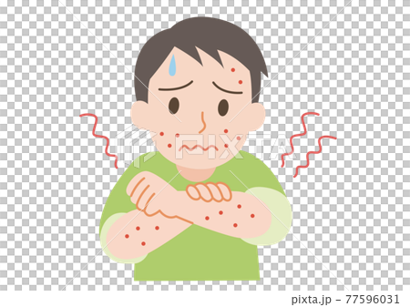 じんましんの出ている男性 77596031