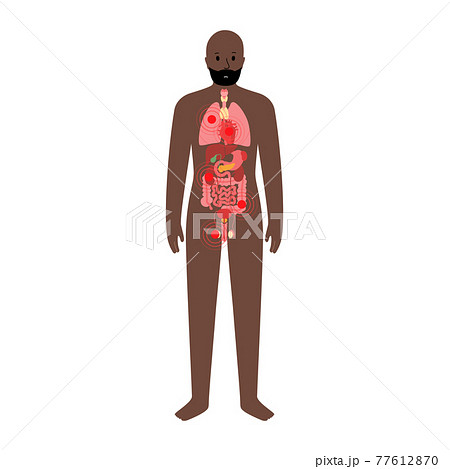 Pain in male body 77612870