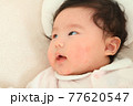 赤ちぃやん、赤児 77620547