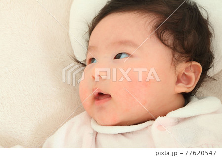 赤ちぃやん、赤児 77620547
