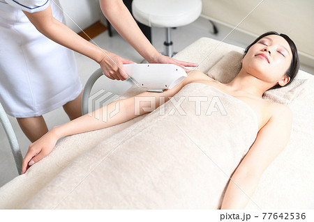 脱毛の施術を受ける若い女性 77642536