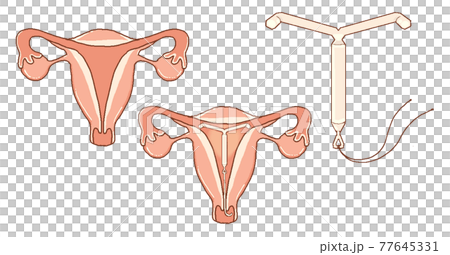 Milena and Uterus: Transparent PNG Milena and Uterus: Transparent PNG 77645331