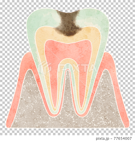 Cross section of cavities (C2) Cross section of cavities (C2) 77654007