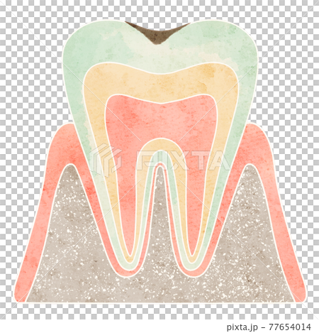 Cross section of cavities (C1) 77654014