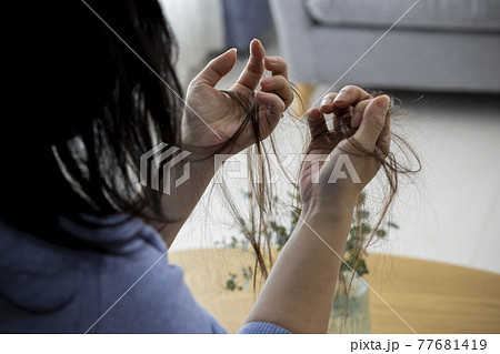 脱毛イメージ 脱毛イメージ 77681419