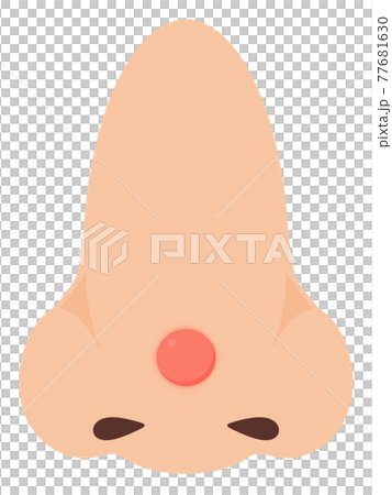 めんちょう 77681630