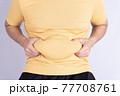 Fat man holding excessive fat belly isolated grey background. 77708761