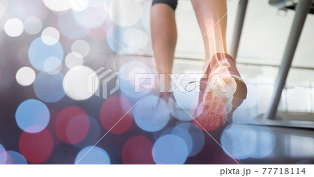 Composition of woman running on treadmill with leg bones visible and spots of light Composition of woman running on treadmill with leg bones visible and spots of light 77718114