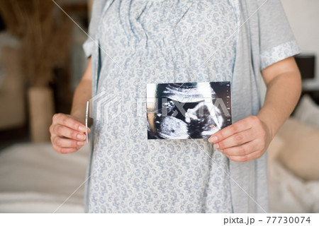 Pregnant woman looking at baby ultrasound scan. Pregnant woman looking at baby ultrasound scan. 77730074