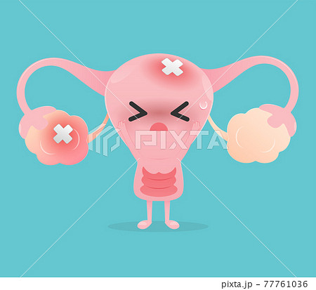 Illustration uterus inflamed ovary Illustration uterus inflamed ovary 77761036