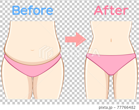 ダイエット ビフォーアフター 77766482
