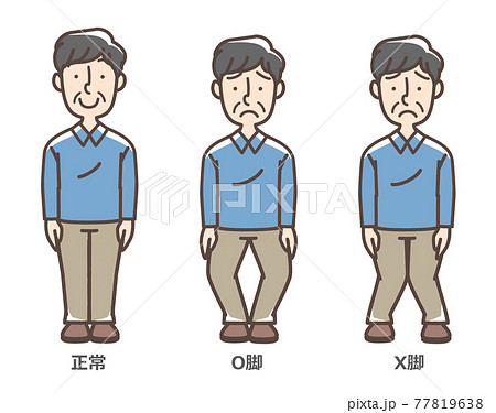 変形性膝関節症　男性 77819638