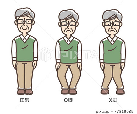 変形性膝関節症 おじいさん 変形性膝関節症 おじいさん 77819639