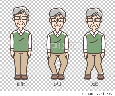 変形性膝関節症 おじいさん 変形性膝関節症 おじいさん 77819639