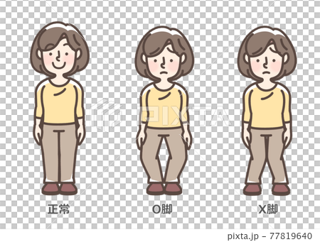 膝關節骨關節炎女性 插圖素材 圖庫