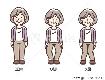変形性膝関節症　おばあさん 77819641