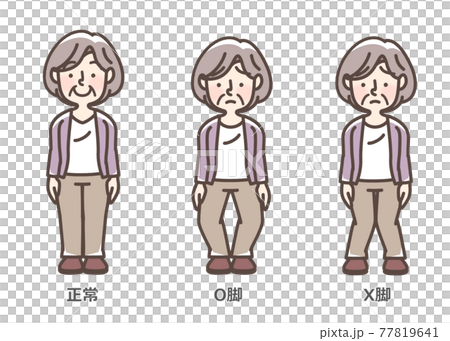 変形性膝関節症　おばあさん 77819641