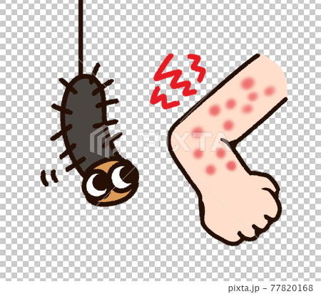 昆蟲咬臂和毛毛蟲 77820168