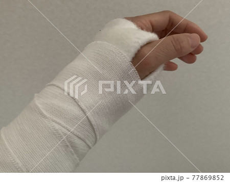 手首を怪我して包帯した姿 手首を怪我して包帯した姿 77869852