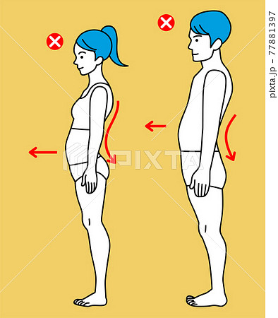 反り腰 男女の姿勢 全身図 側面のイラスト素材