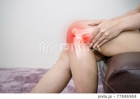 Human leg osteoarthritis inflammation of bone joints 77886968