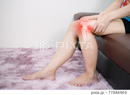 Human leg osteoarthritis inflammation of bone joints Human leg osteoarthritis inflammation of bone joints 77886969