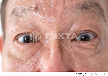 シニア男性　顔　目元 77926264