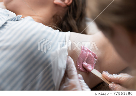 Hand of cosmetologist applying wax paste on armpit. Hand of cosmetologist applying wax paste on armpit. 77961296