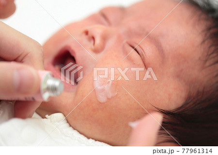 新生児の乳児湿疹に薬を塗るママ 新生児の乳児湿疹に薬を塗るママ 77961314