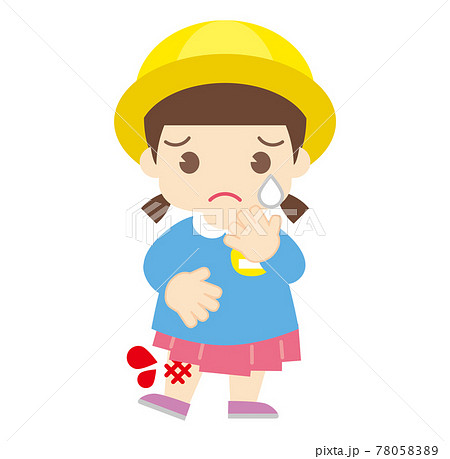 膝を擦りむいて泣いている女の子（帽子あり） 78058389