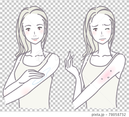 スキンケアをする女性と肌トラブルの女性 セット スキンケアをする女性と肌トラブルの女性 セット 78058732