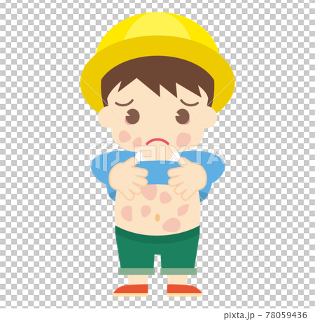 じんましんが出てしまった男の子（帽子あり） 78059436