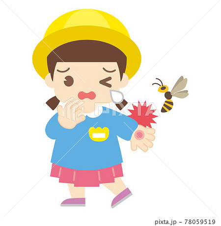蜂に刺されてしまった女の子(帽子なし) 蜂に刺されてしまった女の子(帽子なし) 78059519