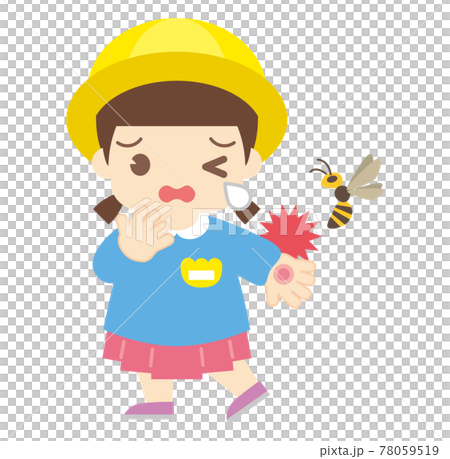 Girl bitten by a bee (without hat) 78059519