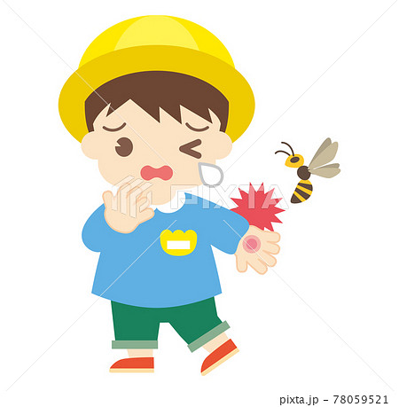 蜂に刺されてしまった女の子（帽子なし） 78059521