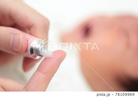 新生児の乳児湿疹に薬を塗るママ 78109969